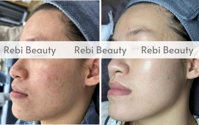 Hình ảnh 1 của Rebi Beauty
