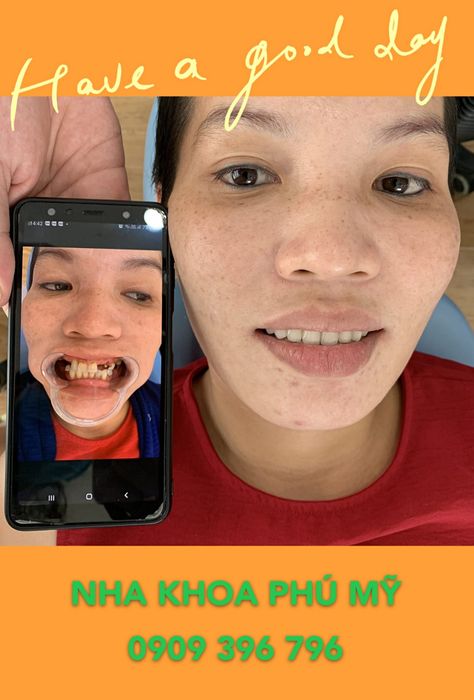 Hình ảnh NHA KHOA PHÚ MỸ 2