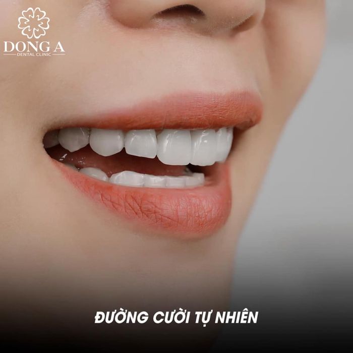 Hình ảnh Nha Khoa Đông Á 1