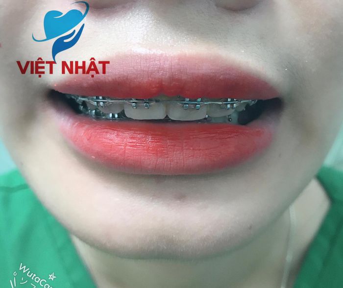 Hình ảnh 2 của Nha khoa Việt Nhật