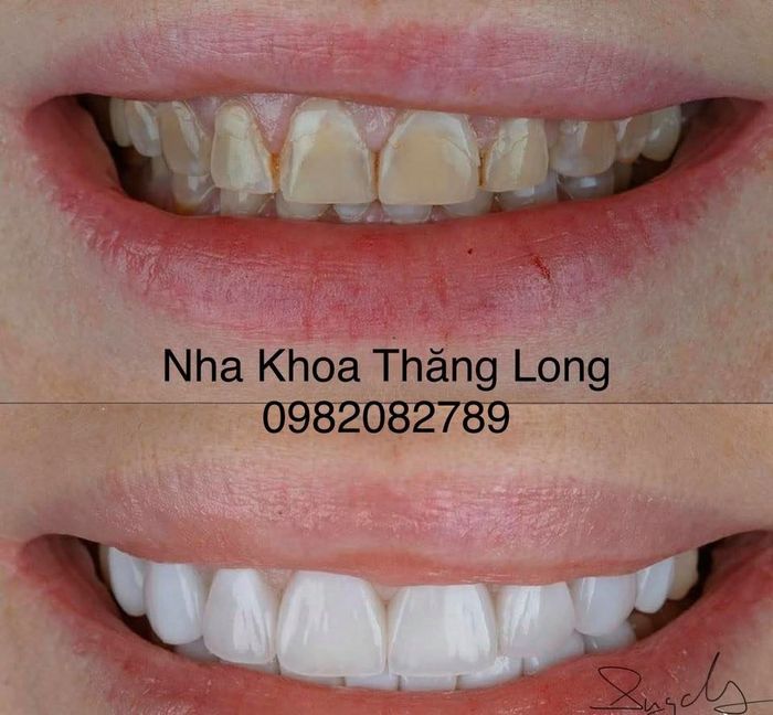Hình ảnh Nha khoa Thăng Long Hà Nam 1