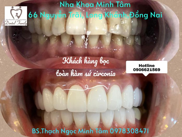 Hình ảnh Basso 1