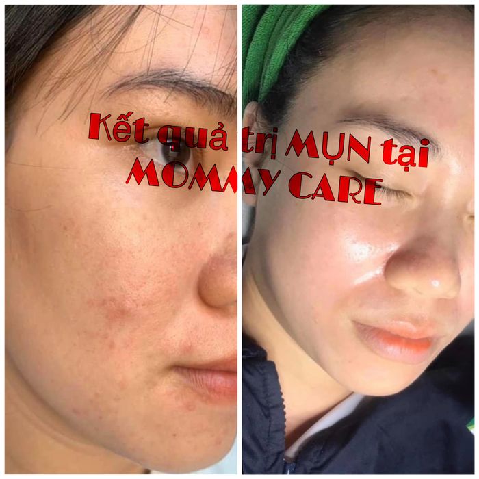 Ảnh 2 tại MOMMY CARE - Viện Thẩm Mỹ Thủy Tiên