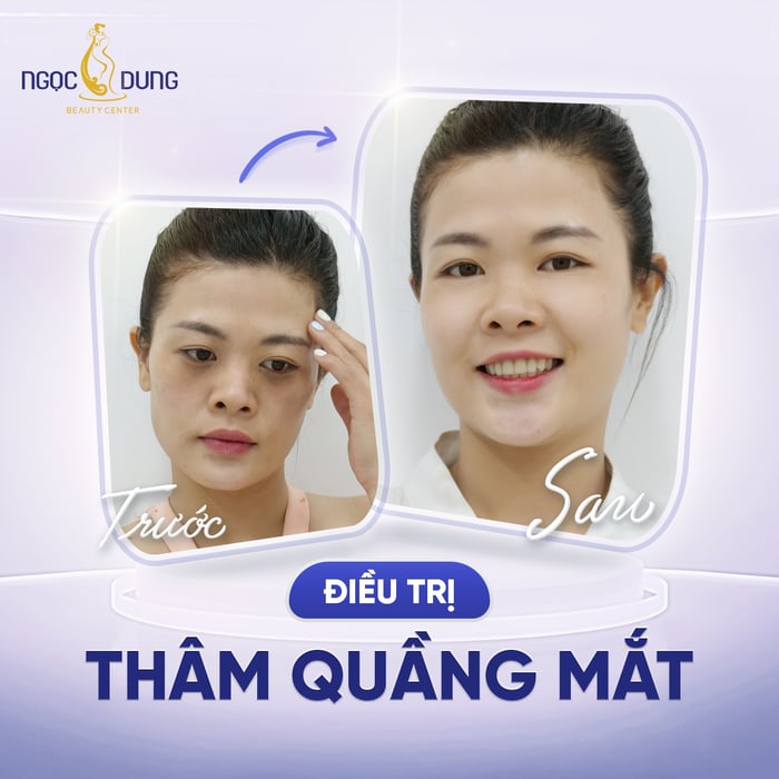 Thẩm Mỹ Viện Ngọc Dung Biên Hòa - Hình ảnh 2