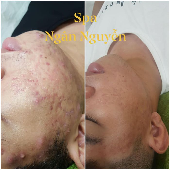 Hình ảnh Spa Ngân Nguyễn 1