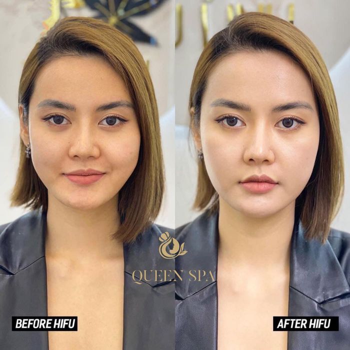 Thẩm Mỹ Queen Spa - Hình ảnh 1