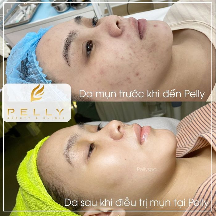 Hình ảnh 2 tại Pelly Spa Trảng Bàng