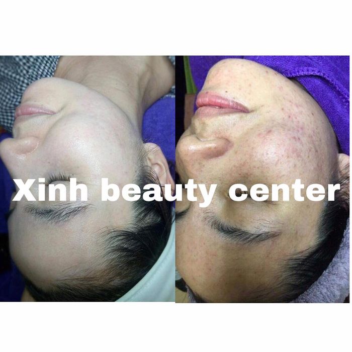 Ảnh 2 tại Xinh Beauty Center