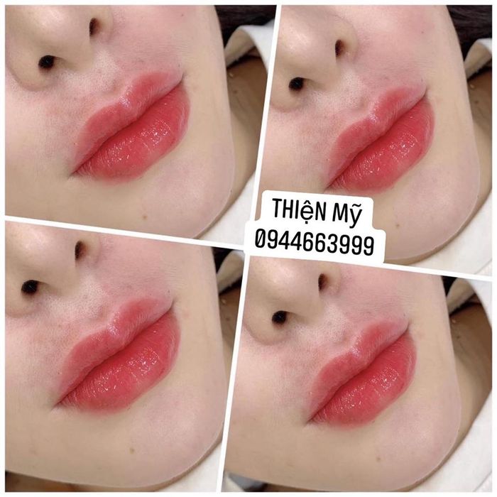 Hình ảnh Thiện Mỹ Beauty Spa 1