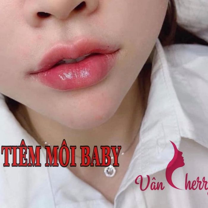 Hình ảnh 2 của Vân Cherry Beauty Spa