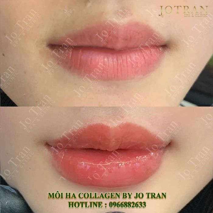 Hình ảnh 2 tại Jo Tran Spa & Clinic