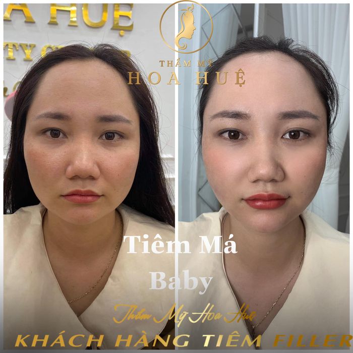 Ảnh 2 của Thẩm Mỹ Quốc Tế Hoa Huệ