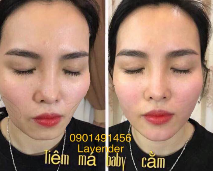 Hình ảnh 1 của Lybeauty (Lavender)