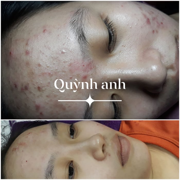 Hình ảnh Spa Quỳnh Anh 2