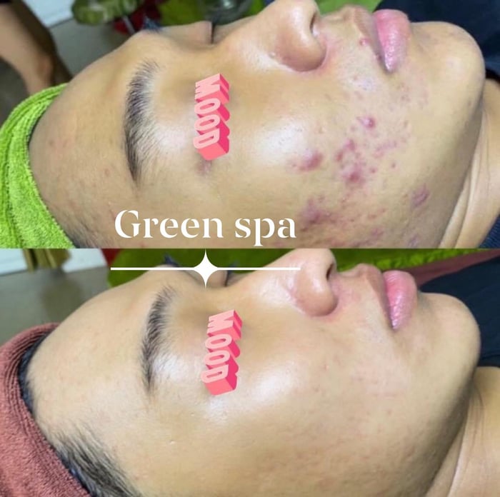 Hình ảnh GreenSpa 1