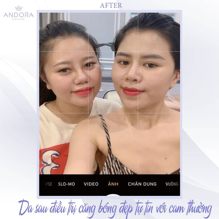 Hình ảnh 1 của Andora Beauty & Clinic