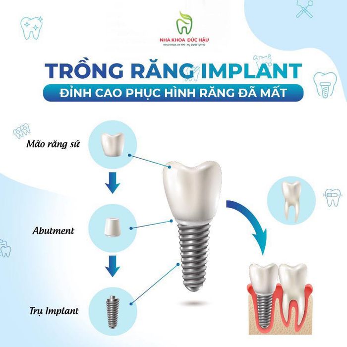 Hình ảnh 1 Nha Khoa Đức Hậu