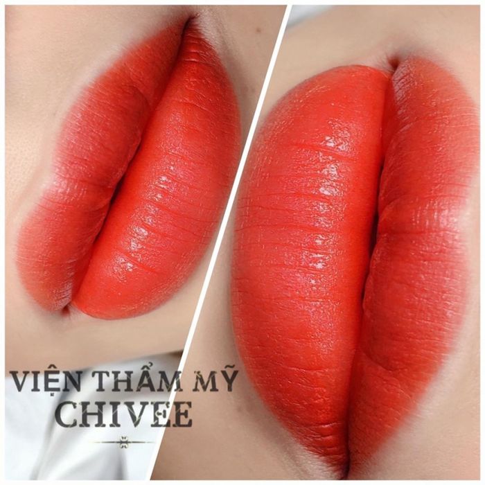 Hình ảnh 1 tại Viện Thẩm Mỹ ChiVee