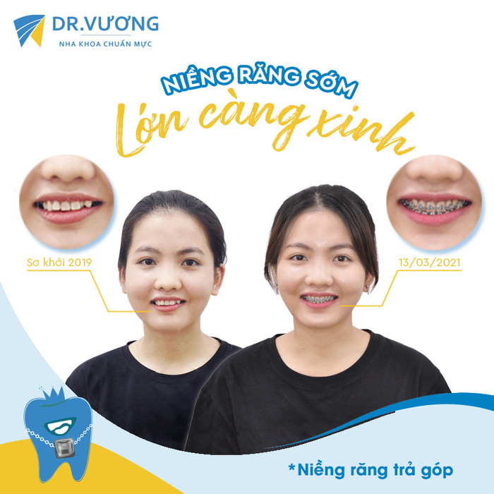 Nha Khoa Dr Vương - Hình ảnh 2