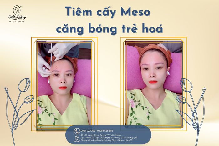 Hình ảnh 2 - Thẩm Mỹ Việt Phượng