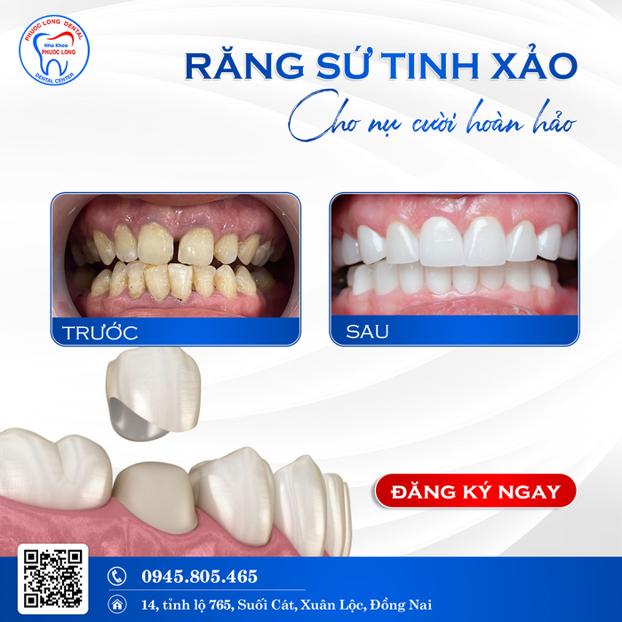 Hình ảnh của Nha Khoa Phước Long - Ảnh 1