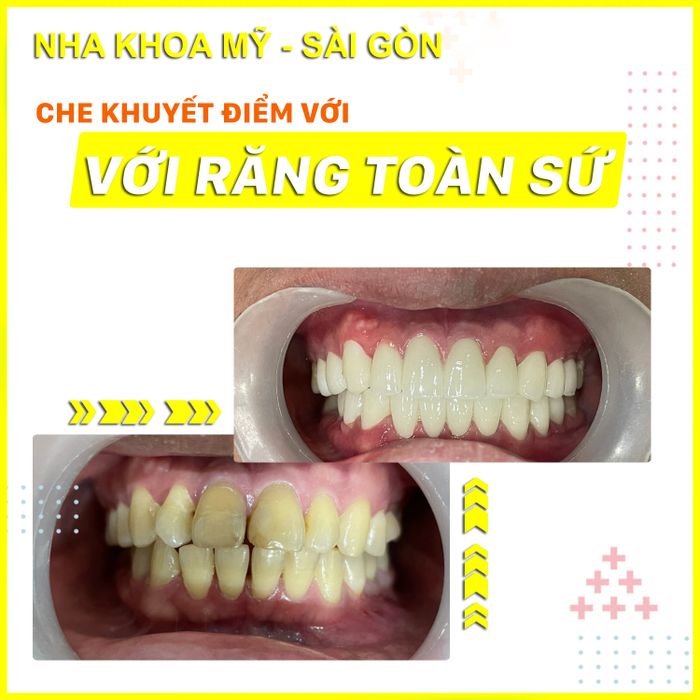 Hình ảnh của Nha Khoa MỸ SÀI GÒN 3