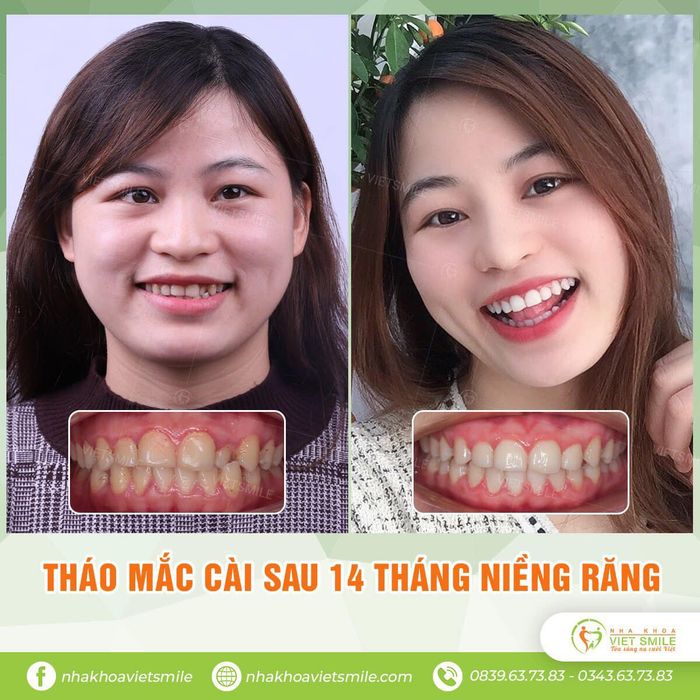 Hình ảnh 2 của VIET SMILE - Viện Thiết Kế Nụ Cười 4.0