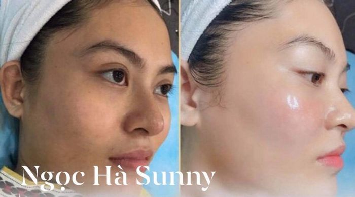 Viện chăm sóc sắc đẹp - Spa Ngọc Hà Sunny ảnh 2