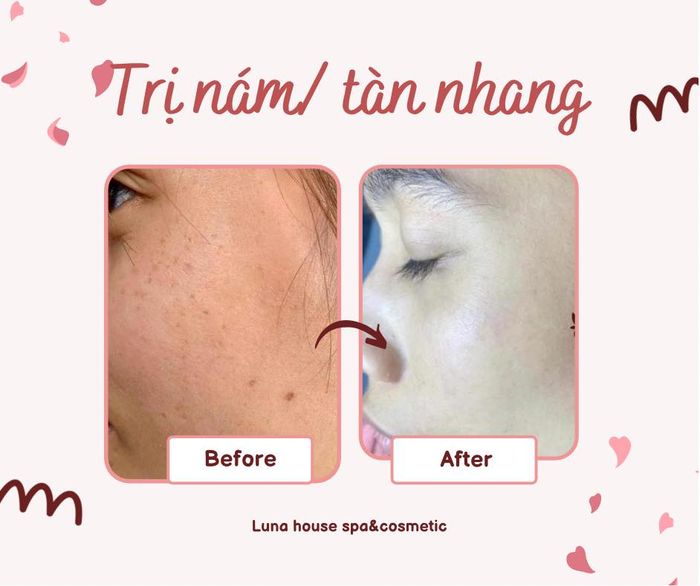 Hình ảnh Luna House Spa & Cosmestic - 2