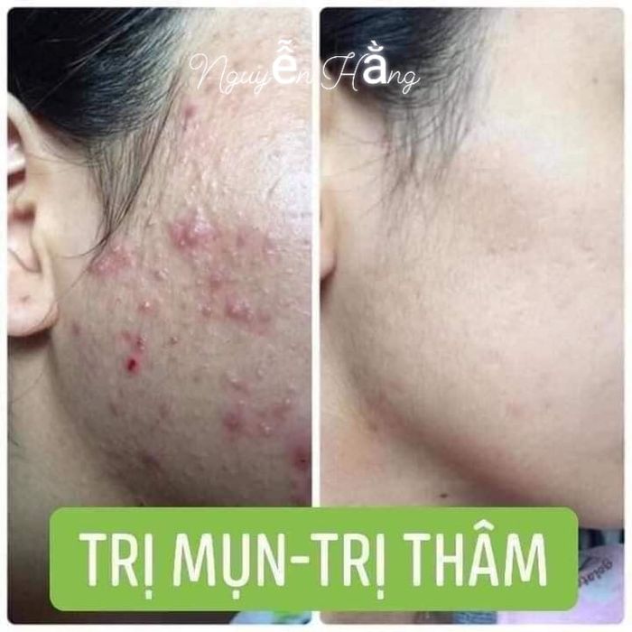 Spa Hồng Lam (Nguyễn Hằng) hình ảnh 2