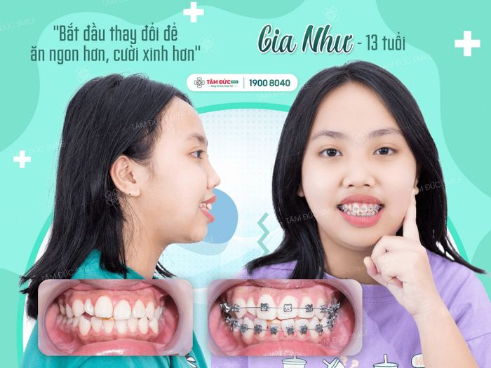 Nha Khoa Tâm Đức Smile - Hình 3