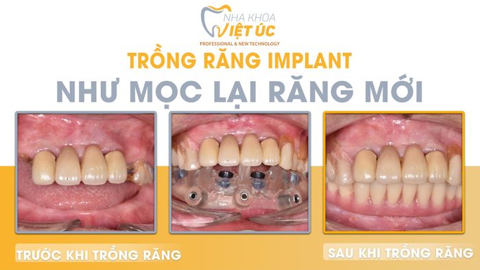 Nha khoa Việt Úc hình ảnh 2