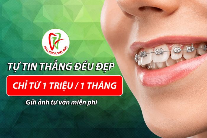 Nha Khoa Việt Đức - Hình ảnh số 3