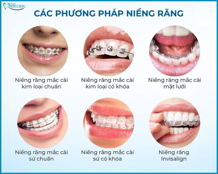 Hình ảnh Nha Khoa Minh Châu 2