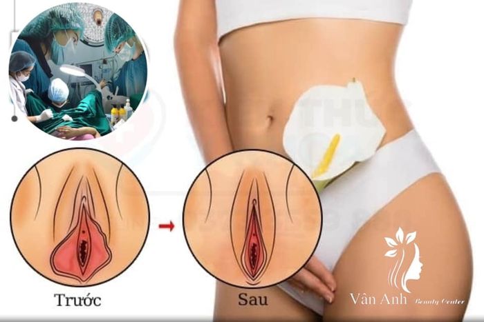 Hình ảnh Vân Anh Beauty Center 2