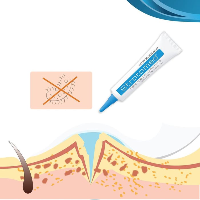 Kem Stratamed hỗ trợ làm mờ sẹo - Hình ảnh 1