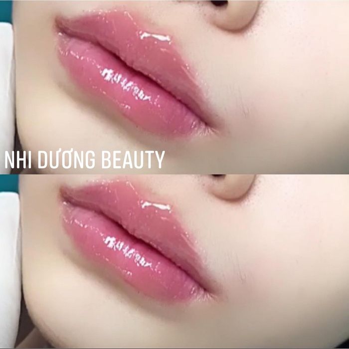 Nhi Dương Beauty - Ảnh 1