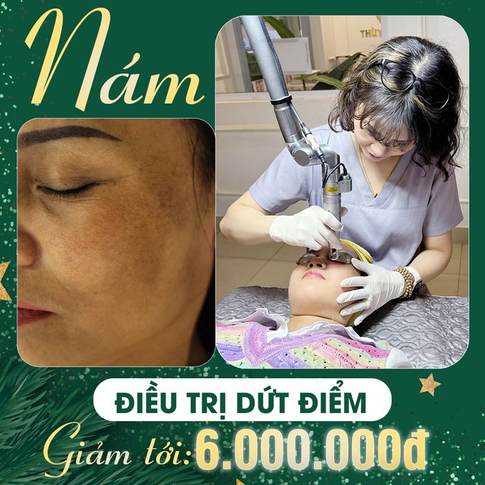 Ảnh 2 của Thẩm Mỹ Thùy Dung