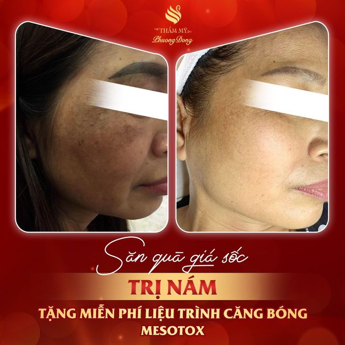 Hình ảnh Thẩm Mỹ Phương Đông 2