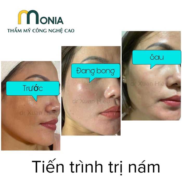 Ảnh 1 của Thẩm mỹ công nghệ cao Monia