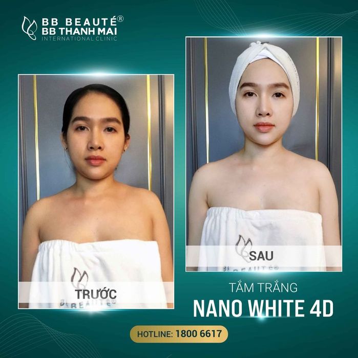 BB Beauté – BB Thanh Mai - Hình ảnh 1