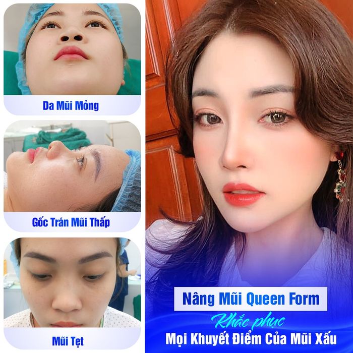 Hình ảnh Thẩm Mỹ Viện Hương Giang 1