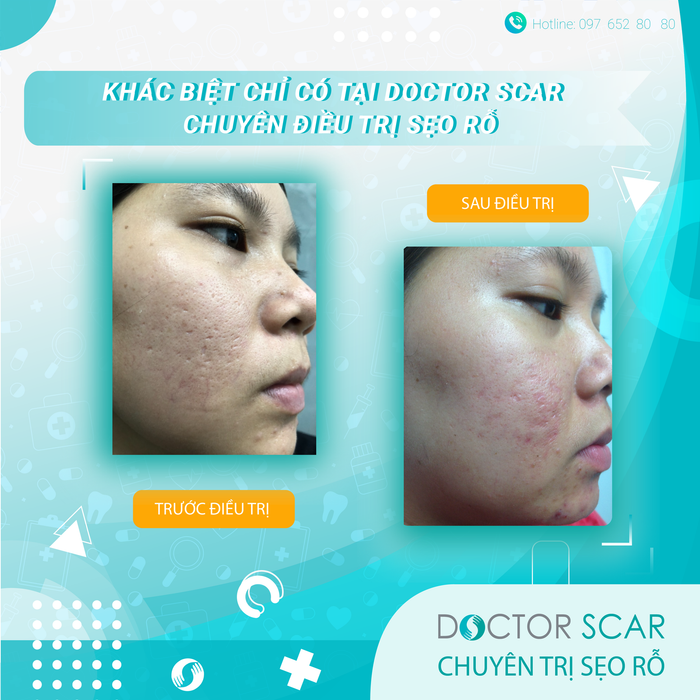 Hình ảnh Phòng Khám Doctor Scar số 2