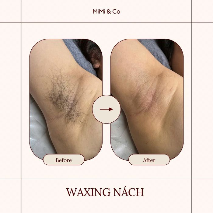 Hình ảnh của MiMi & Co Waxing 1