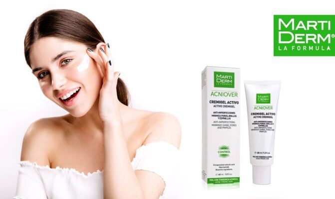 Hình ảnh Kem Dưỡng Điều Tiết Nhờn và Se Khít Lỗ Chân Lông MartiDerm Acniover Cremigel Active 1