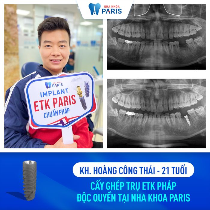 Hình ảnh 3 của Nha Khoa Paris