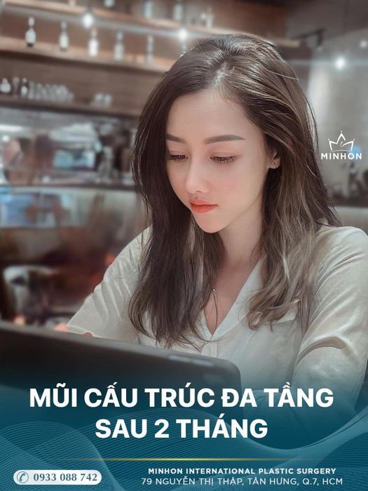 Ảnh Viện Thẩm Mỹ Quốc Tế Minhon 1