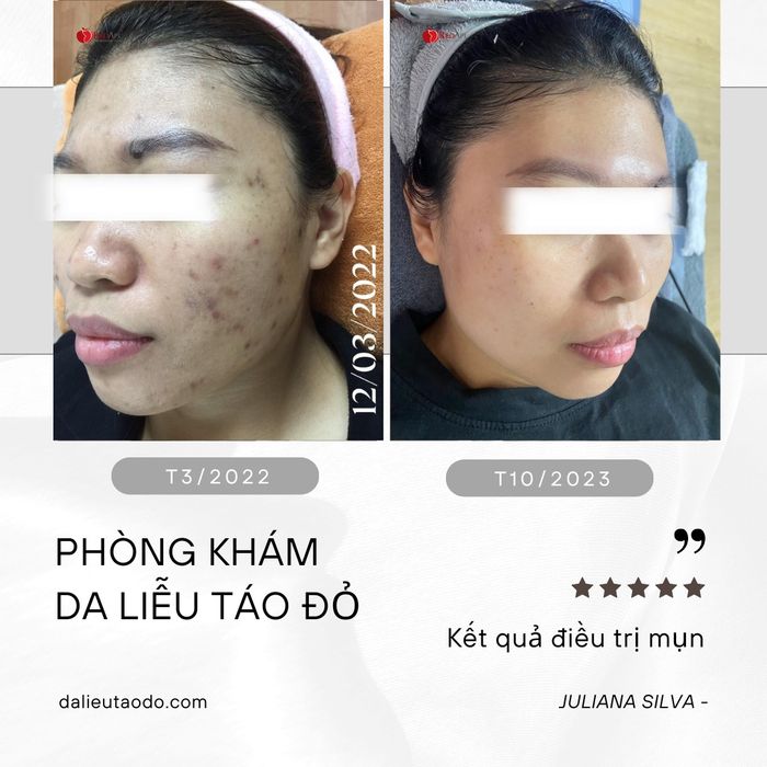 Hình ảnh 2 của PHÒNG KHÁM DA LIỄU TÁO ĐỎ CHUYÊN SÂU