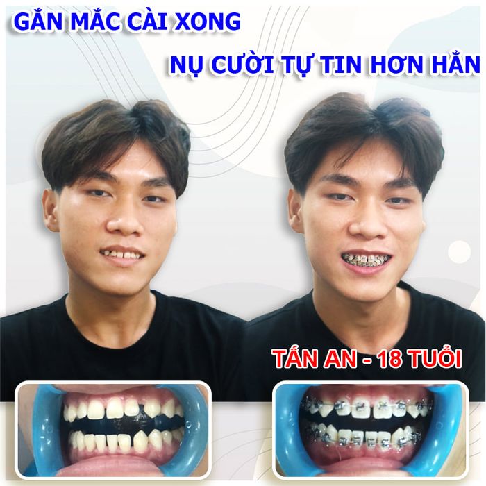 Nha Khoa Quốc Tế Việt Pháp hình 1