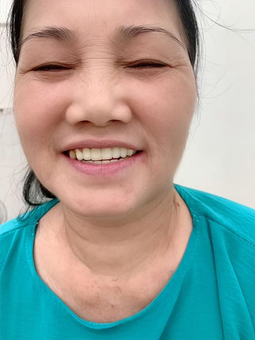 Ảnh Nha Khoa Sài Gòn Smile 2